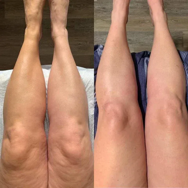 FirmThera customer review from Denise